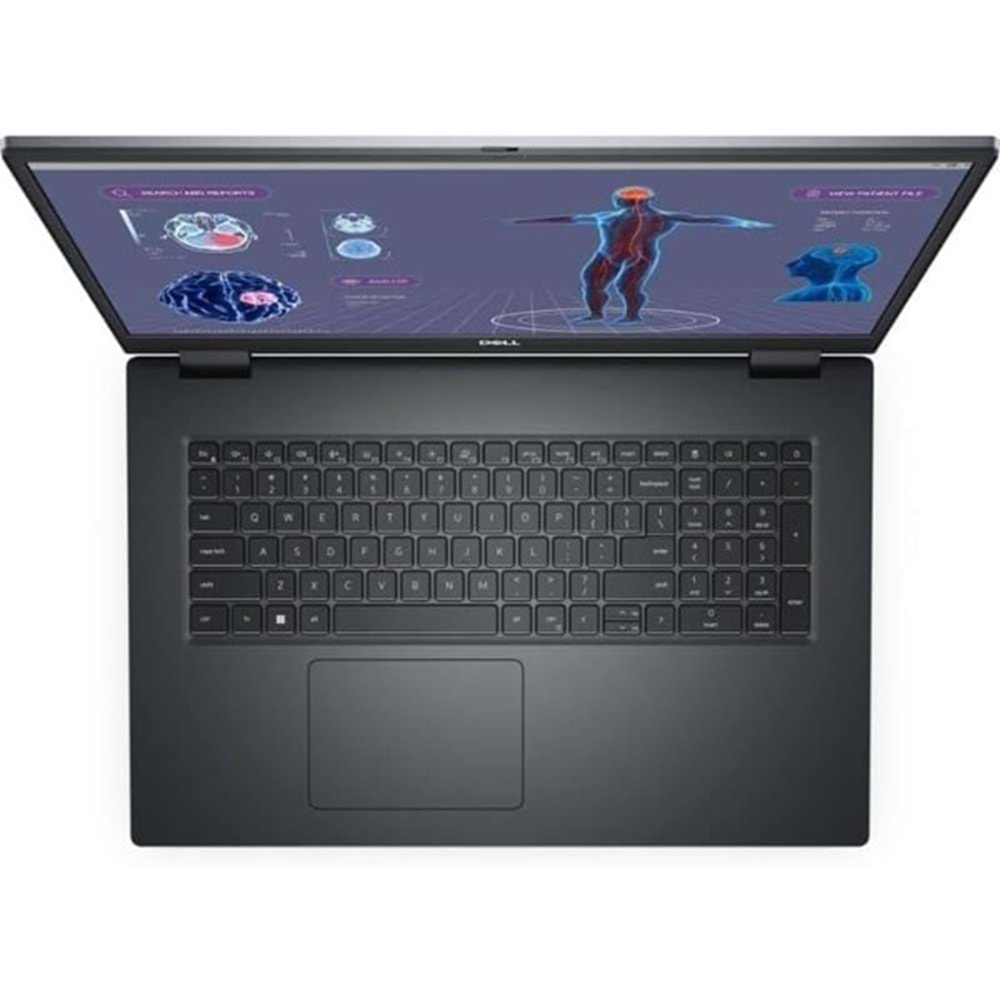 DELL 17.3